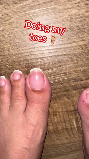 DIY Gel Pedicure: Fixing Broken Toenails & At-Home Gel Removal