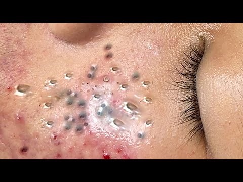 Enjoy Every Day With The Best Video Loan Nguyen Spa # 2822