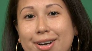 Xeomin Widens This Woman's Eyes — See Her Results