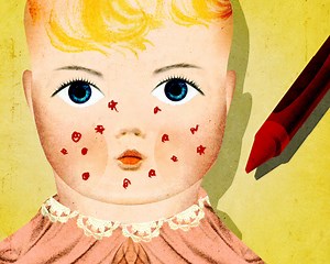 Younger Children Seek an Acne Cure