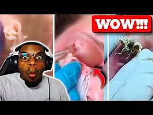 LOOK AT HER EYE CYST! 😱