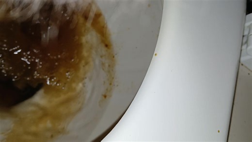 Magnesium citrate diarrhea 2