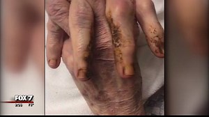 ***WARNING: GRAPHIC CONTENT*** As Ashley Paredez on FOX 7 explains, an employee at a North Austin nursing home has been suspended. He reportedly played a cruel joke on one of the patients and then posted the video to social media. The Texas Department of Aging and Disability Services, DADS is investigating, along with the Austin Police Department. We want to warn you, what you're about to see is disturbing. http://bit.ly/2oevCWL | FOX 7 Austin