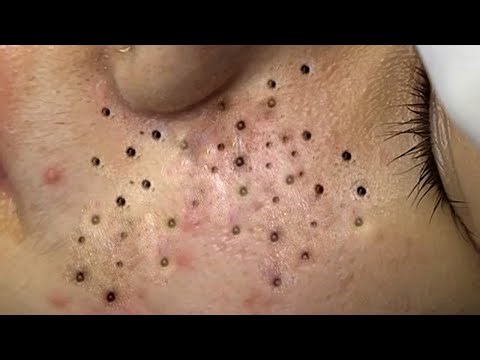 Enjoy Your Day With Hien Nguyen Spa # 1255