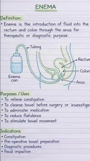 “Enema: A simple yet effective method for bowel cleansing.” #medicalnotes #conceptclear #education