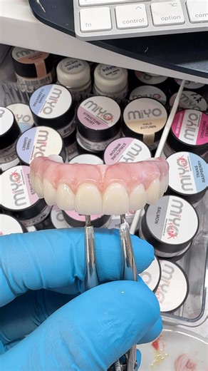 Tsuyoshi Matsuzawa(Yoshi) on Instagram: "Zirconia All-on-X with MiYO Structure Pink🦷🎨 Before polish✨ Zero Cutback System🔥 -MiYO @miyo_experts @Jensen_dental @miyo.expert -Whitepeaks Copra Supreme ML Pro @whitepeaksdental @xyzdental 🗓️Course Available Nov 7(Fri)-8(Sat), 2025🔥 📍Costa Mesa, CA, USA 📝Details in the post✨ or @globaldentalgallery #zirconia #dentaltechnician #Miyo #miyopink #dentistry #oralrehabilitation #AOX #stomatology #stomatolog #allon4 #allonx #стоматология #stomatology #f