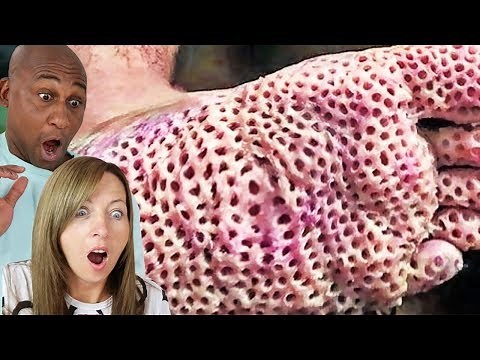THE FEAR OF HOLES!! Trypophobia Test (Watch If You Dare)