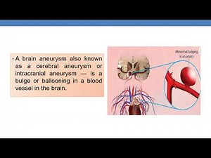 HOW TO SEARCH A CPT CODE WITH QUESTION FROM REPAIR OF ANEURYSM OF THE INTRACRANIAL ARTERY- 23