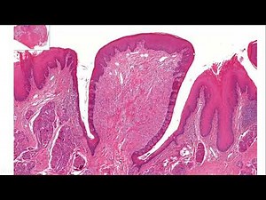 HISTOLOGÍA DE LENGUA