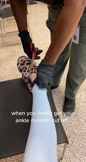 Ankle Monitor Removal Process: Step-by-Step Guide