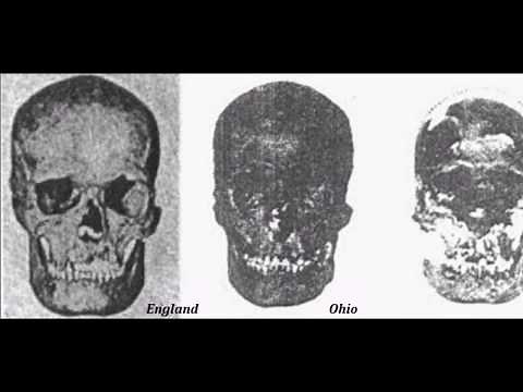 Identical Nephilim Giant's Skulls Discovered in England and Ohio
