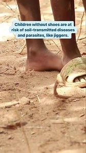 Why are jiggers dangerous? 🤔 In areas where clean water and soap aren't readily available, or for families who can't afford healthcare, jigger bites can lead to infection from bacteria that gets in through the open wound. Sometimes, if the host's body is unable to get rid of the jigger after it has died, complications can occur. If left untreated, these infections can lead to tetanus, gangrene, limb loss and even death. Learn more about jiggers and how The Shoe That Grows can help: https://beca