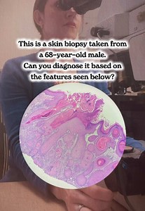 Can you make the diagnosis? 🤔🔬 #pathology #pathologystudent #histology #underthemicroscope #medicalstudent
