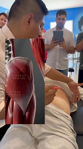 168K views · 3.3K reactions | Anatomía palpatoria zona glútea #fisioterapia #quiropraxia #osteopatia #terapiafisica #dolormuscular | Richard Ferro | Facebook