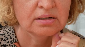 Stomatitis Mouth Closeup Lip Aphthous Stomatitis: video stock (100% royalty free) 3512275787 | Shutterstock