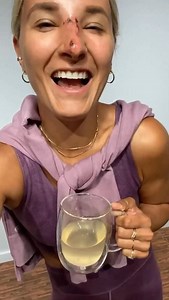 18K views · 25 comments | 1-year post op rhinoplasty/septoplasty +...