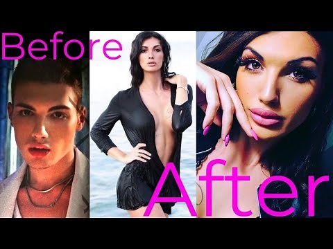 Male To Female | MTF Transition Timeline | Transgender Model