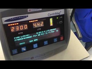 ECMO emergencies: access insufficiency