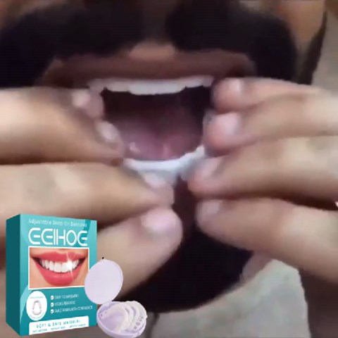 2pcs adjustable snap on dentures with polypropylene non-invasive temporary filling for gaps and orthodontic dentures kit