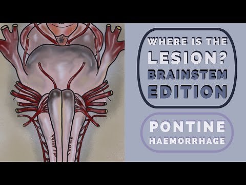 Brainstem Reflexes: Where is the lesion?