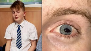 Caz TULBURATOR! Adolescent injunghiat in ochi cu un creion. Agresorul este un coleg de scoala