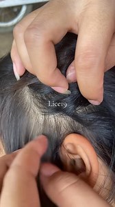 57K views · 252 reactions | Lice treatment  #lice #fyp | Mariani Kiyim | Facebook