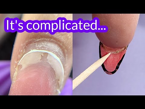 Extreme Gel Fill - Cleaning Under the Nail, Lifting | Yafex Nail Drill Review