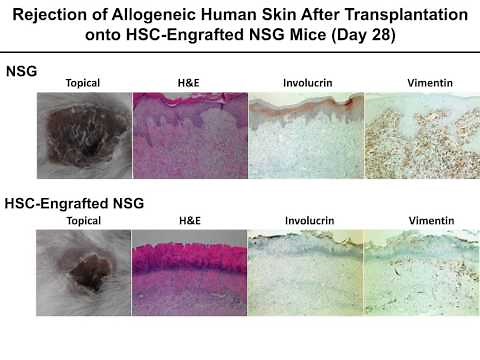 Humanized Mouse Models for Biomedical Research: Selection and Experimental Implications