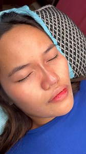 2.6K views · 40 reactions | Non surgical Hiko noselift thread | Ara Lashes Brows | Facebook