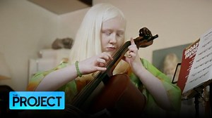 57K views · 561 reactions | The young women in this story have it all, and with the sixth International Albinism Awareness Day celebrated on the weekend, we think they’re qualities worth celebrating. | The Project | Facebook