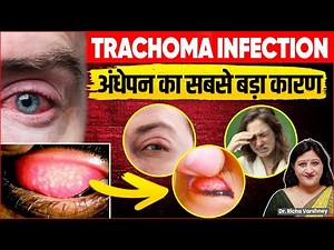 How To Cure Trachoma Disease | Eye Disease And Disorder