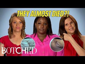 Knocking On Death’s Door: Septic Shock, Deformed Organs and MORE?! (Compilation) | Botched | E!
