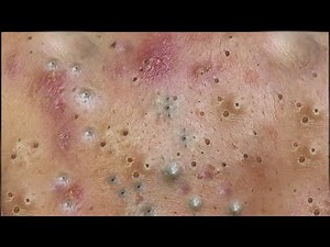 Satisfying Relaxing with Best Video 2021 Windy Spa #029