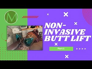 Non invasive BBL + Vacuum Therapy + Cupping Technique + Wood Therapy + Body Sculpting + Hip dips Pt1
