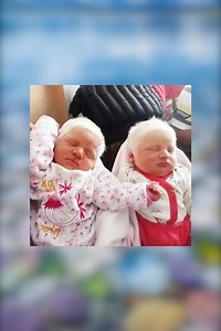The First Ever Albino Twins Born In Argentina Will Leave You In Awe | Besos Dulces