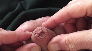 Foreskin and urethral dilation, urethral sounding