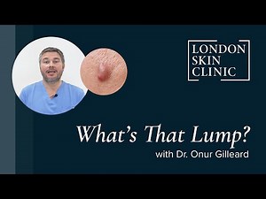 What's That Lump? | Understanding Cysts and When to See a Doctor | London Skin Clinic