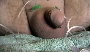 Saline Infusion 1,8L im Sack 0.5 gallon in scrotum