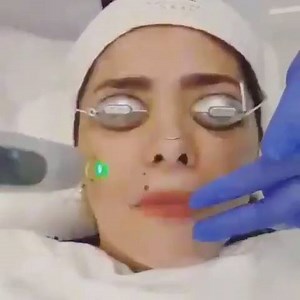 Happy Ongpauco-Tiu, Chef/Restauranteur Par Excellance does the K-Poreless Contour Laser Treatment at Kamiseta Skin. This treatment is to eliminate her double chin, achieve smooth and poreless skin and to contour and tighten her jawline. @happyongpauco_tiu Call 📞 0917-625-8438 // (02) 514-7336 // (02) 637-1345 to book your appointment! Kamiseta Skin is located at: 3/F Ayala Malls The 30th, Meralco Ave. Pasig, Manila. #KamisetaSkinPH #kamisetaskinspiration #KamisetaSkinExperience | Kamiseta