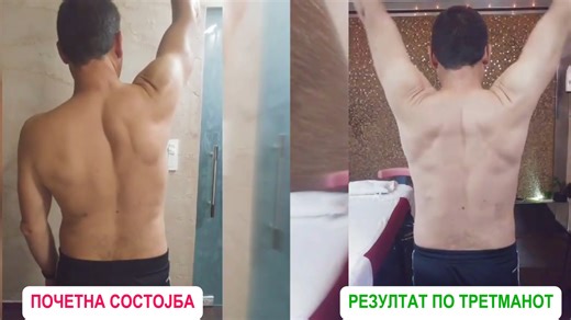 EDEM Wellness Center ✅ Излечена болка во рамо и дискенеза на...