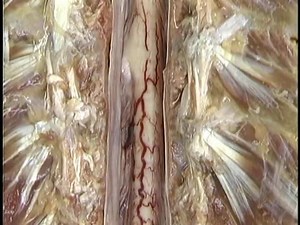 3.4K views · 77 reactions | The spinal cord in the spinal canal with attachments of the meninges and spinal cord, including the denticulate ligaments | Anatomy and Physiology | Facebook