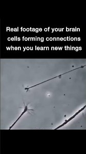 Actual brain cells under microscope 🔬 #facts #medical #science #sciencefacts #medicine