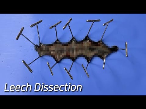 Strange Organ Inside a Leech ! - Leech Dissection