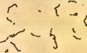 Streptococcus - Alchetron, The Free Social Encyclopedia