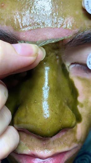 Effective Skin Care Tips for Healthy Skin