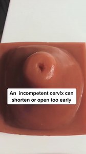 #pretermlabor #preterm #pretermbirth#birthlaborcontractions #midwifemama #TheSuicideSquadMovie | MidwifeMama