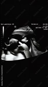 uterus show image pregnancy organ baby organs woman 28 spine 2d fetus ultrasound kidney weeks medicals foetus important lung display care embryo mother pregnant nubes scan stomach diaphragm belly