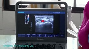 Chittagong E1Exp Color Doppler, Pain Management | Majestic Healthcare Ltd.