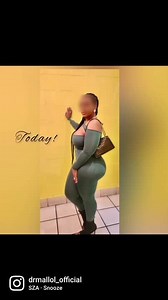 Tummy tuck   Liposuction   DBL