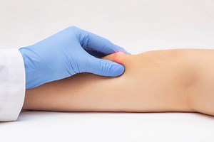 Lipomas, an overview | Emergency Live